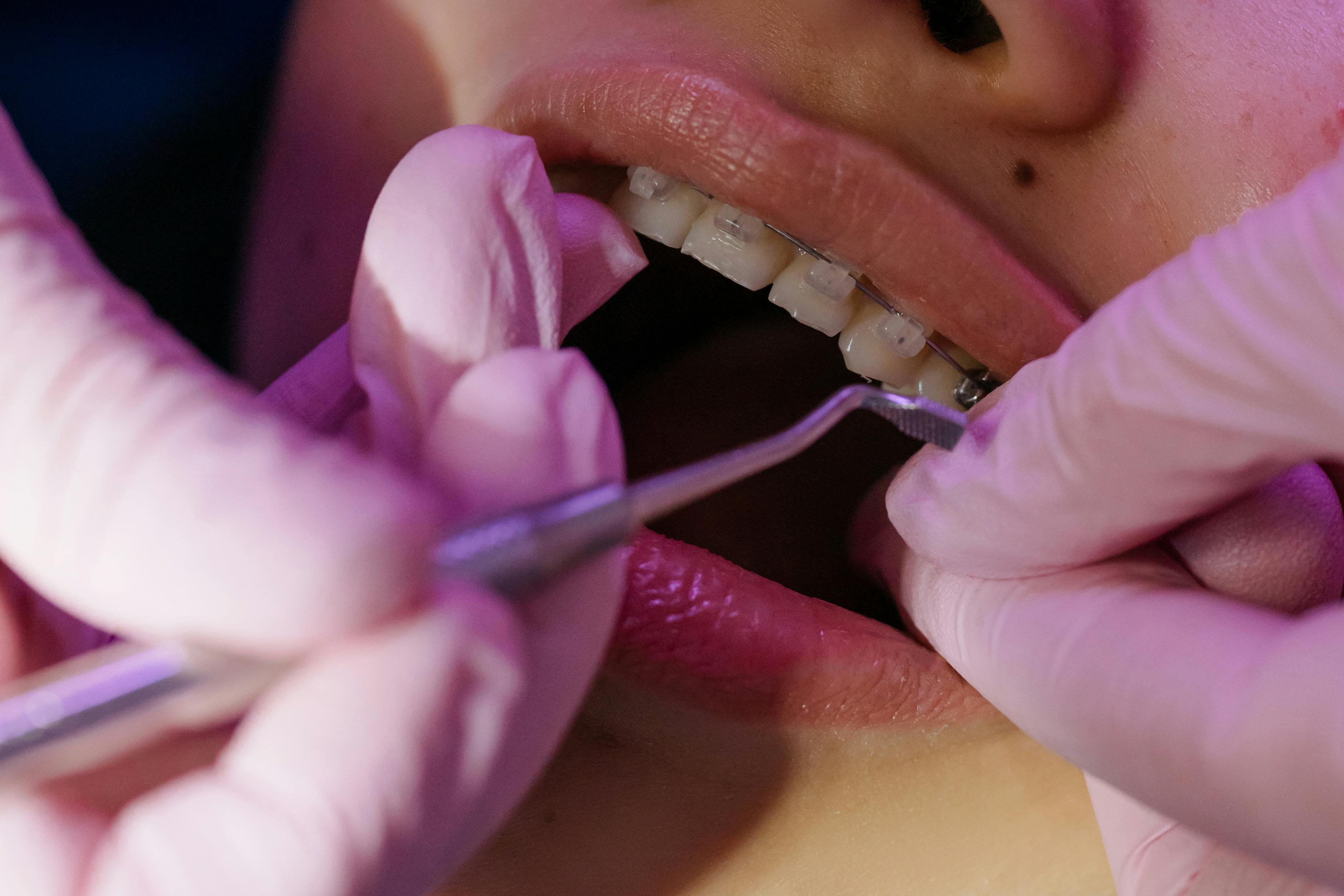 Orthodontics Orthodontics